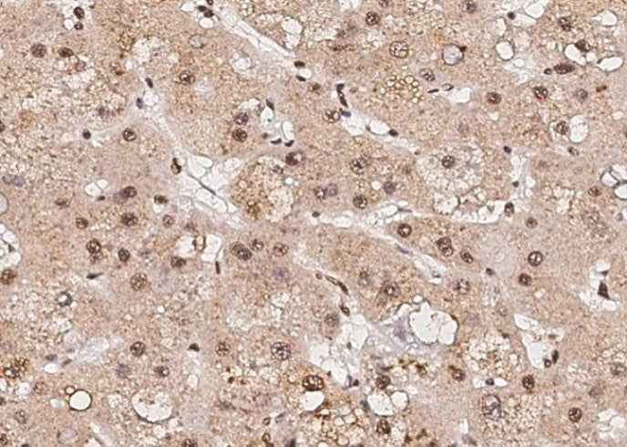Anti-Human RPRD1B Antibody [A989] - ABMIUM
