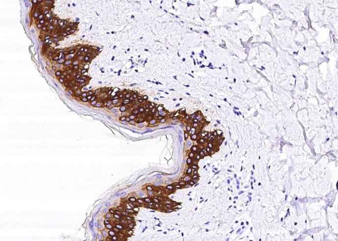Anti-Human KRT14 Antibody [B211] - ABMIUM