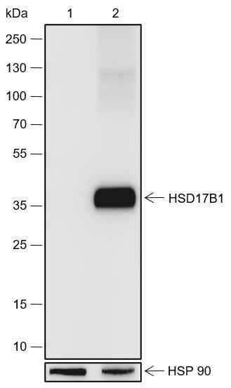 Anti-Human HSD17B1 Antibody [A558] - ABMIUM