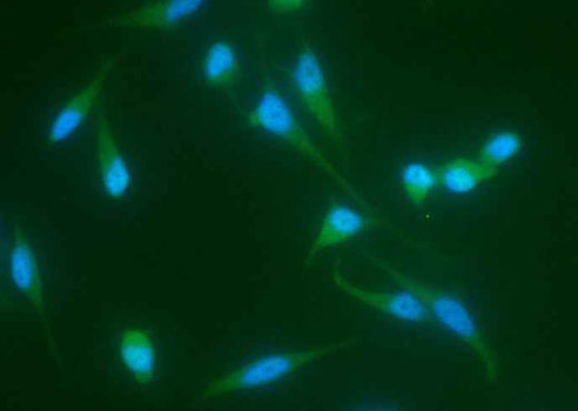 Anti-Human MAPK9 Antibody [B270] - ABMIUM