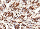 Anti-Human Histone H3 Antibody [A1004] - ABMIUM