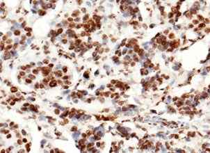 Anti-Human Histone H3 Antibody [A1004] - ABMIUM