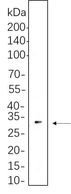 Anti-Human/Mouse/Rat TWIST1 Antibody [B1115] - ABMIUM