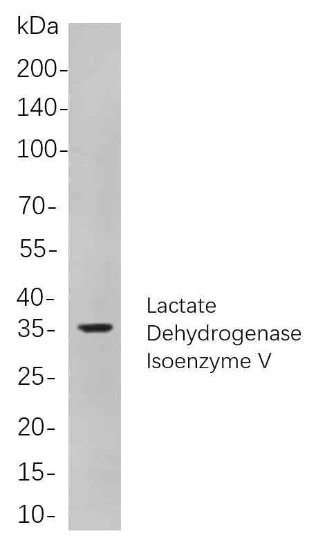 Anti-Human/Mouse/Rat Lactate Dehydrogenase Isoenzyme V Antibody [B850] - ABMIUM