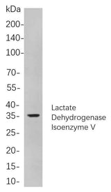 Anti-Human/Mouse/Rat Lactate Dehydrogenase Isoenzyme V Antibody [B850]