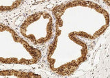 Anti-Human PPIL1 Antibody [B193]