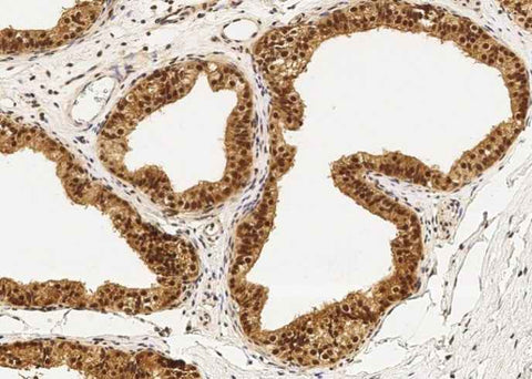 Anti-Human PPIL1 Antibody [B193] - ABMIUM