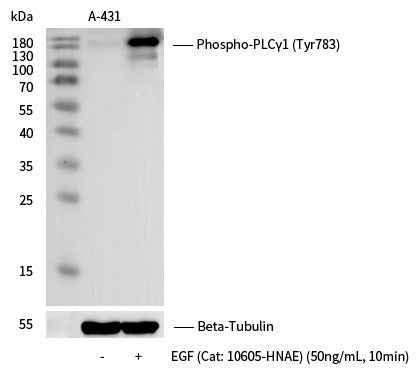 Anti-Human PLCG1 Antibody [A1262] - ABMIUM