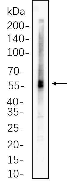 Anti-Human/Mouse/Rat ATGL Antibody [B746] - ABMIUM
