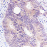Anti-Human/Rat/Mouse SETBP1 Antibody [A359]