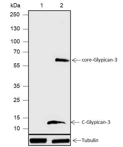 Anti-Human Glypican-3 Antibody [A577] - ABMIUM