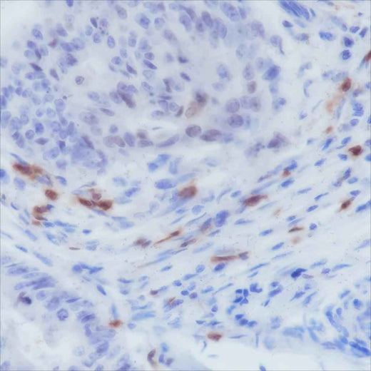 Anti-Human CD103 Antibody [A155] - ABMIUM