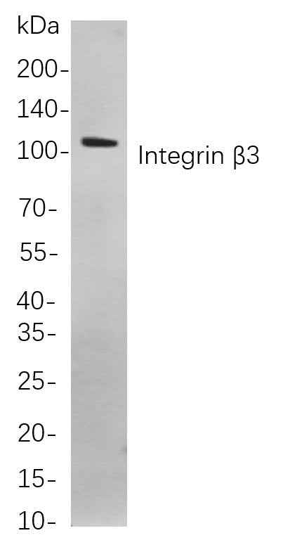 Anti-Human/Mouse/Rat Integrin β3 Antibody [B823] - ABMIUM