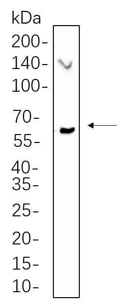 Anti-Human/Mouse/Rat Chk2 Antibody [B530] - ABMIUM