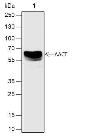 Anti-Human AACT Antibody [A629] - ABMIUM