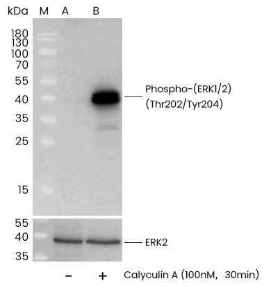 Anti-Human MAPK3 Antibody [B287] - ABMIUM