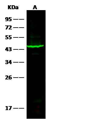 Anti-Human SerpinB1 Antibody [A1072] - ABMIUM