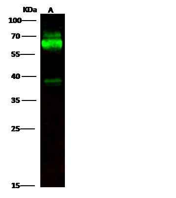 Anti-Mouse TH Antibody [A1281] - ABMIUM