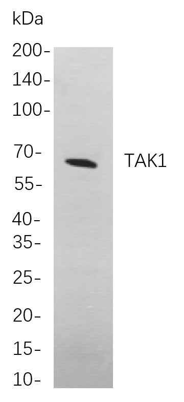 Anti-Human/Mouse/Rat Tak1 Antibody [B710] - ABMIUM