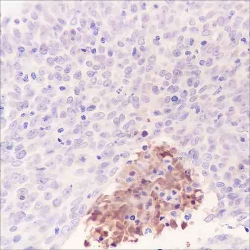 Anti-Human Tenascin X Antibody [A375]