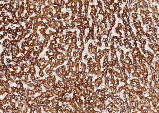 Anti-Human COX5B Antibody [A1209] - ABMIUM