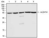 Anti-Human/Rat/Mouse ALDH7A1 Antibody [A560]