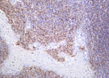 Anti-Human/Mouse/Rat AIM2 Antibody [B1041]