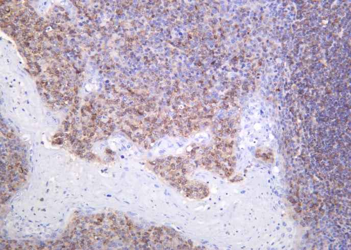Anti-Human/Mouse/Rat AIM2 Antibody [B1041] - ABMIUM