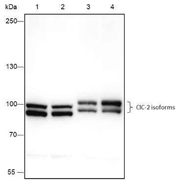 Anti-Human/Rat/Mouse ClC-2 Antibody [A430] - ABMIUM