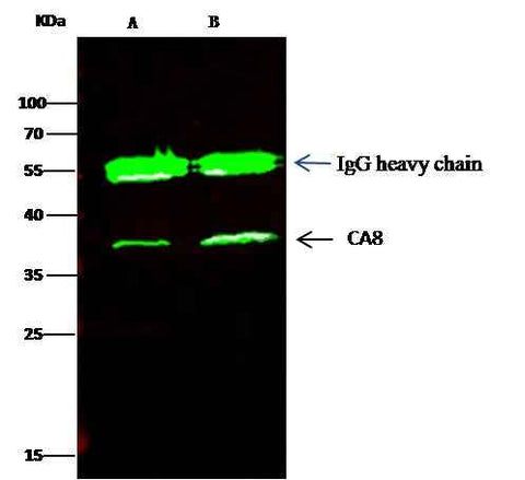 Anti-Human CA8 Antibody [B106] - ABMIUM