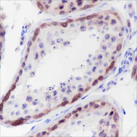 Anti-Human CTAG1B Antibody [A196] - ABMIUM