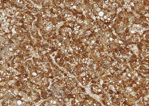 Anti-Human ALDH7A1 Antibody [A876] - ABMIUM