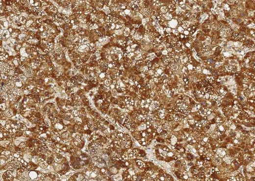 Anti-Human ALDH7A1 Antibody [A876] - ABMIUM