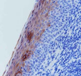 Anti-Human Keratin 4 Antibody [A278]