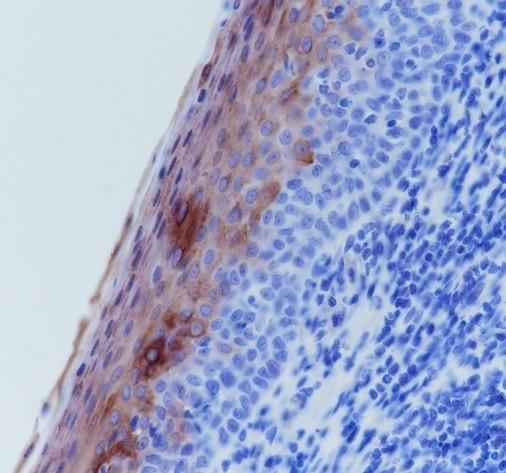 Anti-Human Keratin 4 Antibody [A278] - ABMIUM