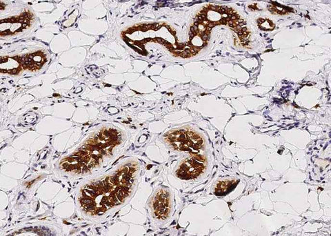 Anti-Human KIT Antibody [B336] - ABMIUM