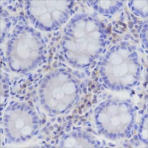 Anti-Human CD50/ICAM3 Antibody [A176] - ABMIUM