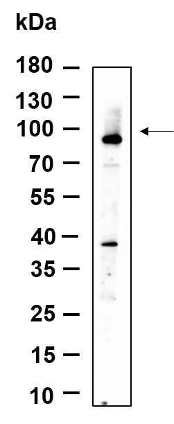 Anti-Human/Mouse/Rat ZNF160 Antibody [B959] - ABMIUM