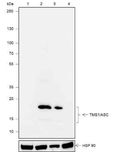 Anti-Human TMS1/ASC Antibody [A619] - ABMIUM