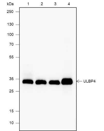 Anti-Human/Rat/Mouse RAET1E Antibody [A581]