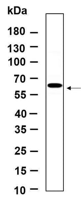 Anti-Human/Mouse/Rat p70 S6 kinase β Antibody [B910]