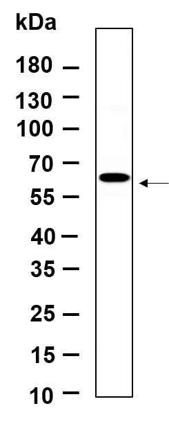 Anti-Human/Mouse/Rat p70 S6 kinase β Antibody [B910] - ABMIUM