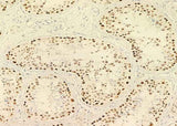 Anti-Human PARP1 Antibody [A1101] - ABMIUM