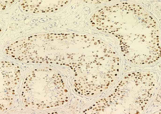 Anti-Human PARP1 Antibody [A1101] - ABMIUM