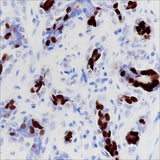 Anti-Human/Mouse Progesterone Receptor Antibody [A339]