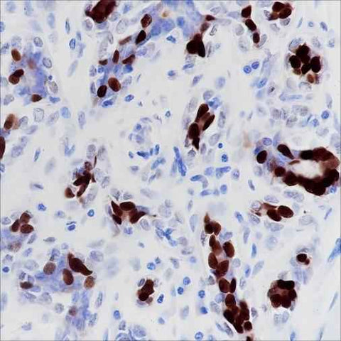 Anti-Human/Mouse Progesterone Receptor Antibody [A339] - ABMIUM