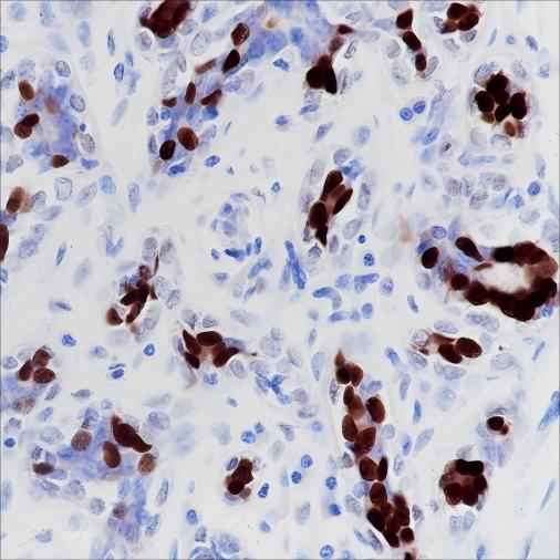 Anti-Human/Mouse Progesterone Receptor Antibody [A339] - ABMIUM