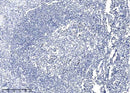 Anti-Human PARP1 Antibody [A883] - ABMIUM