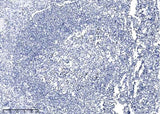 Anti-Human PARP1 Antibody [A883] - ABMIUM