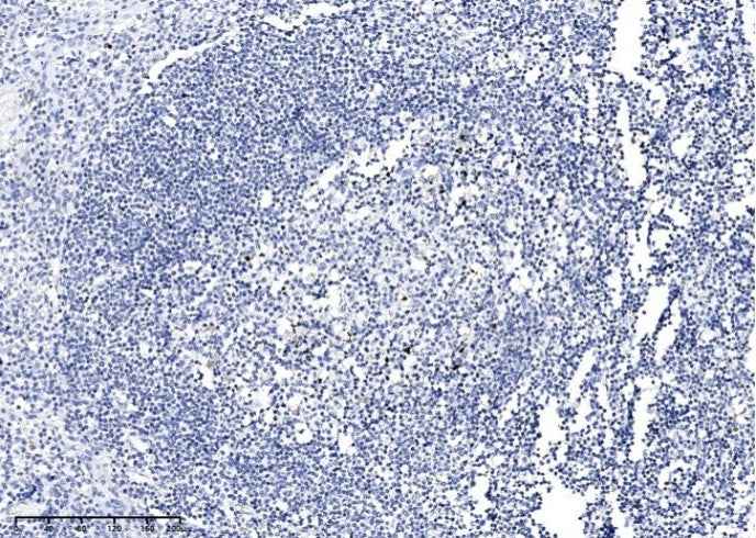 Anti-Human PARP1 Antibody [A883] - ABMIUM